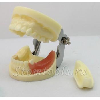 ENOVO Стоматологическая модели имплантов зубов с съемные зубов