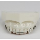 Стоматологическая модели ортодонтия для поддержания M3007