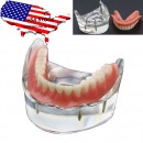США зубные зубы модель 4 имплантаты демо Нижняя модель 6002 02