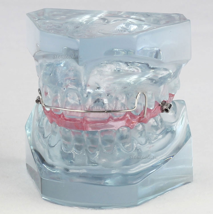 OСтоматологическая модели ортодонтия для поддержания M3006