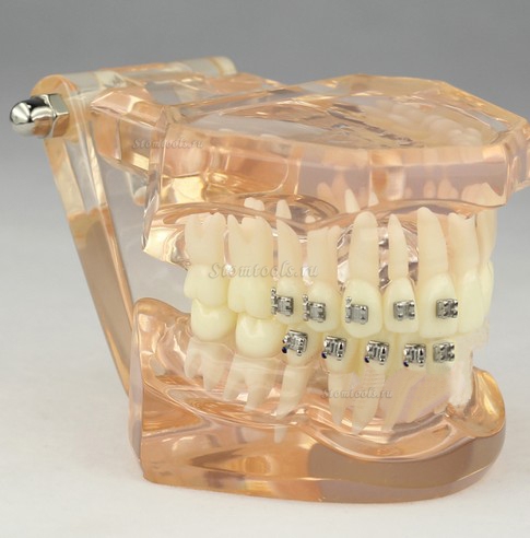Стоматологическая модели ортодонтия с керамической скобки M3009
