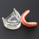Зубов Нижней Зубы Модель Протез 2 Имплантами Демо Модель 6002 01