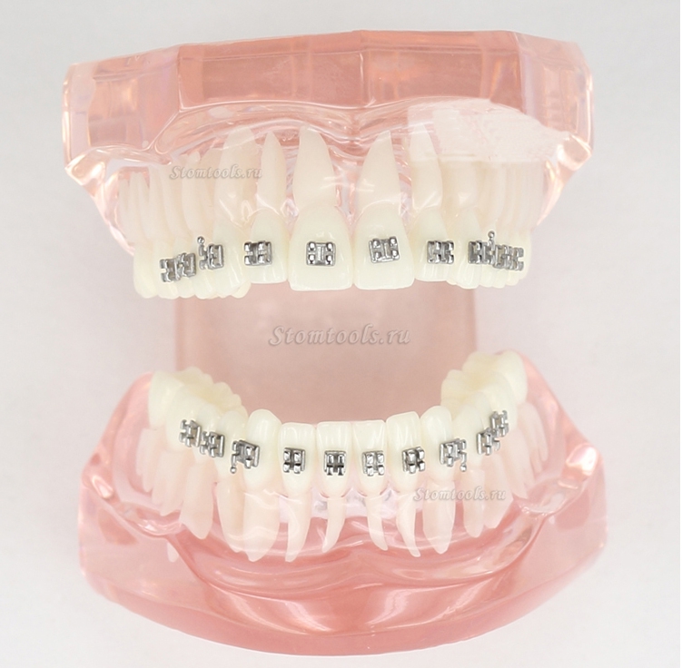 Cтоматологические зубы прикуса текста с металлическими от стандартной модели M3001