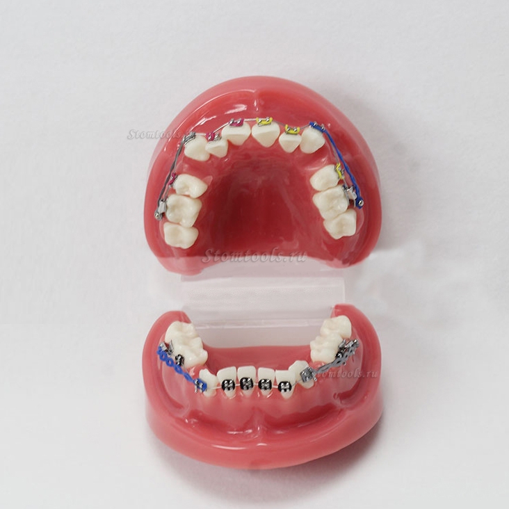 Стоматологические зубы прикуса текста с зубами от стандартной модели M3005